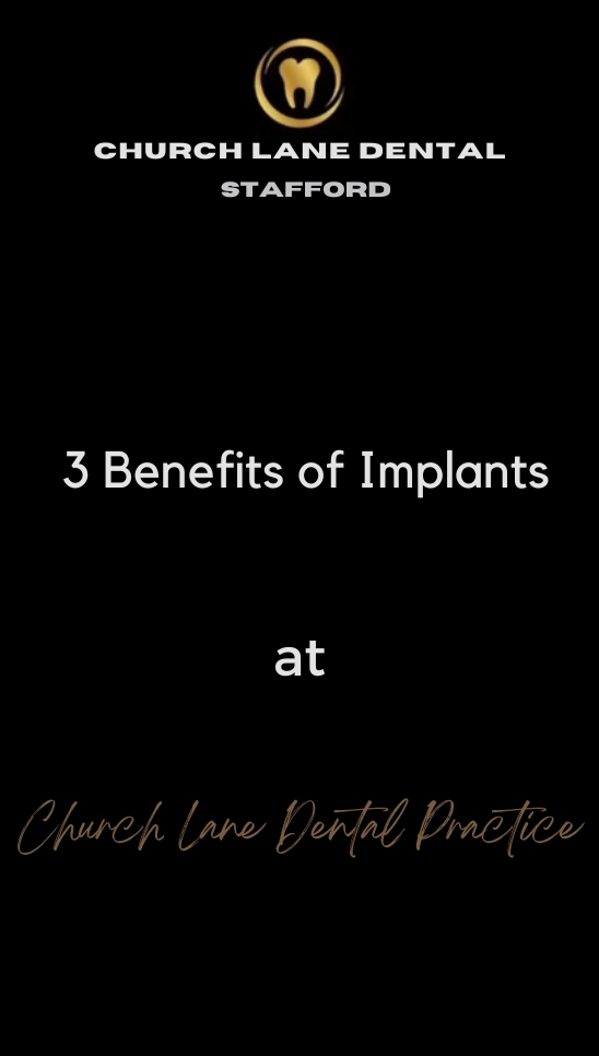 3 Benefits of Implants